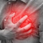 Infarto accidente laboral