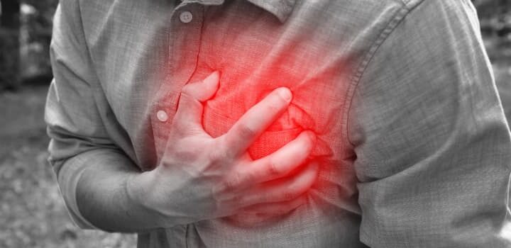 Infarto accidente laboral