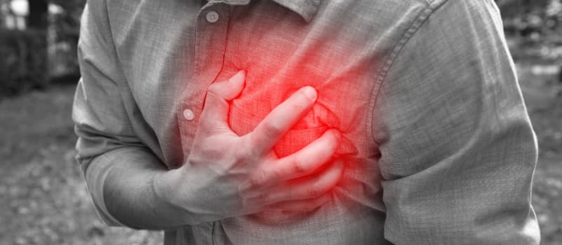 Infarto accidente laboral